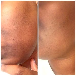 Even tone serum ✨ 1oz bottle ✨